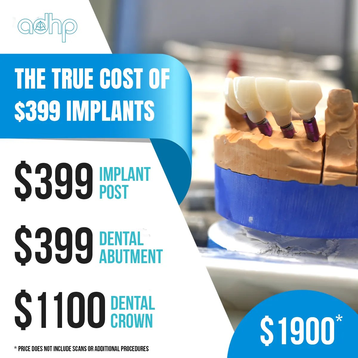Best $399 Dental Implants Near Me Solution