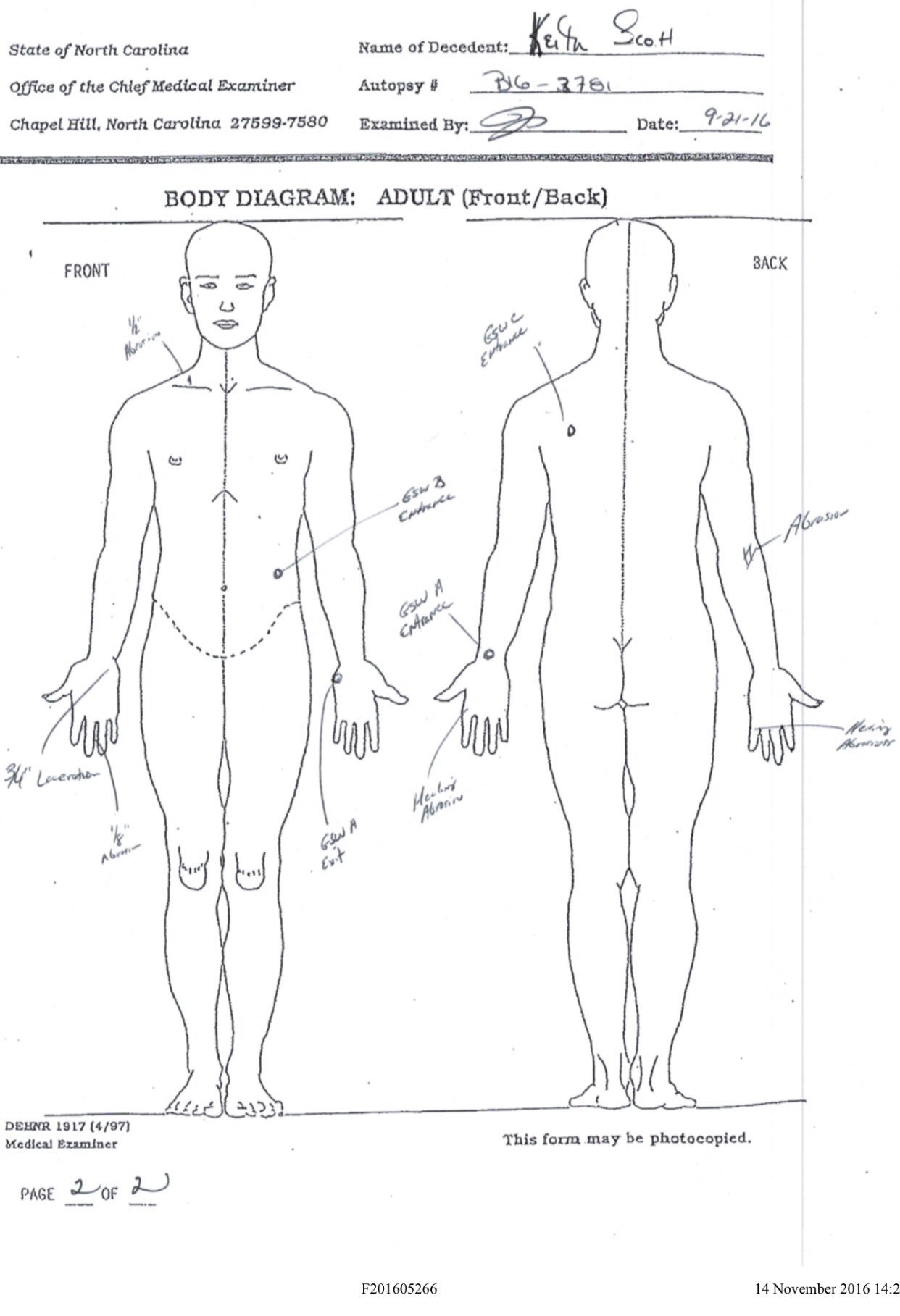 Investigating The Intriguing Gigi Autopsy Sketch